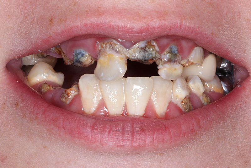 before