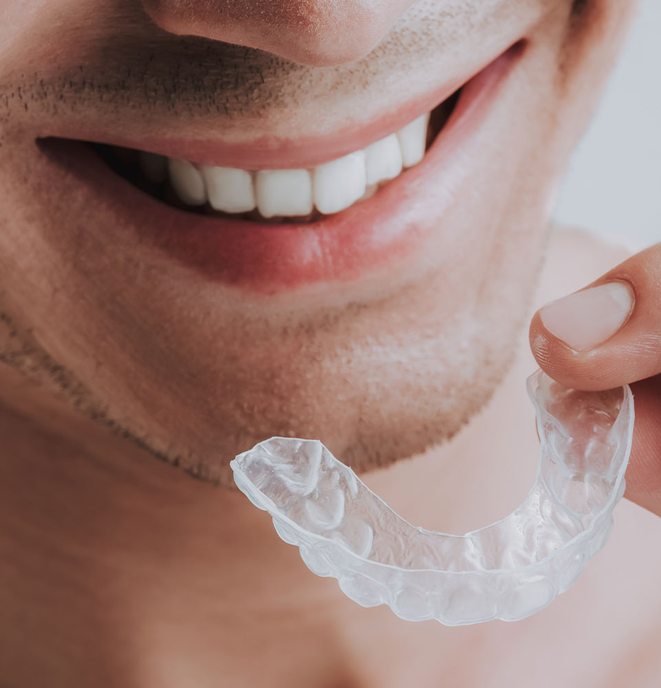 mouthguard smile