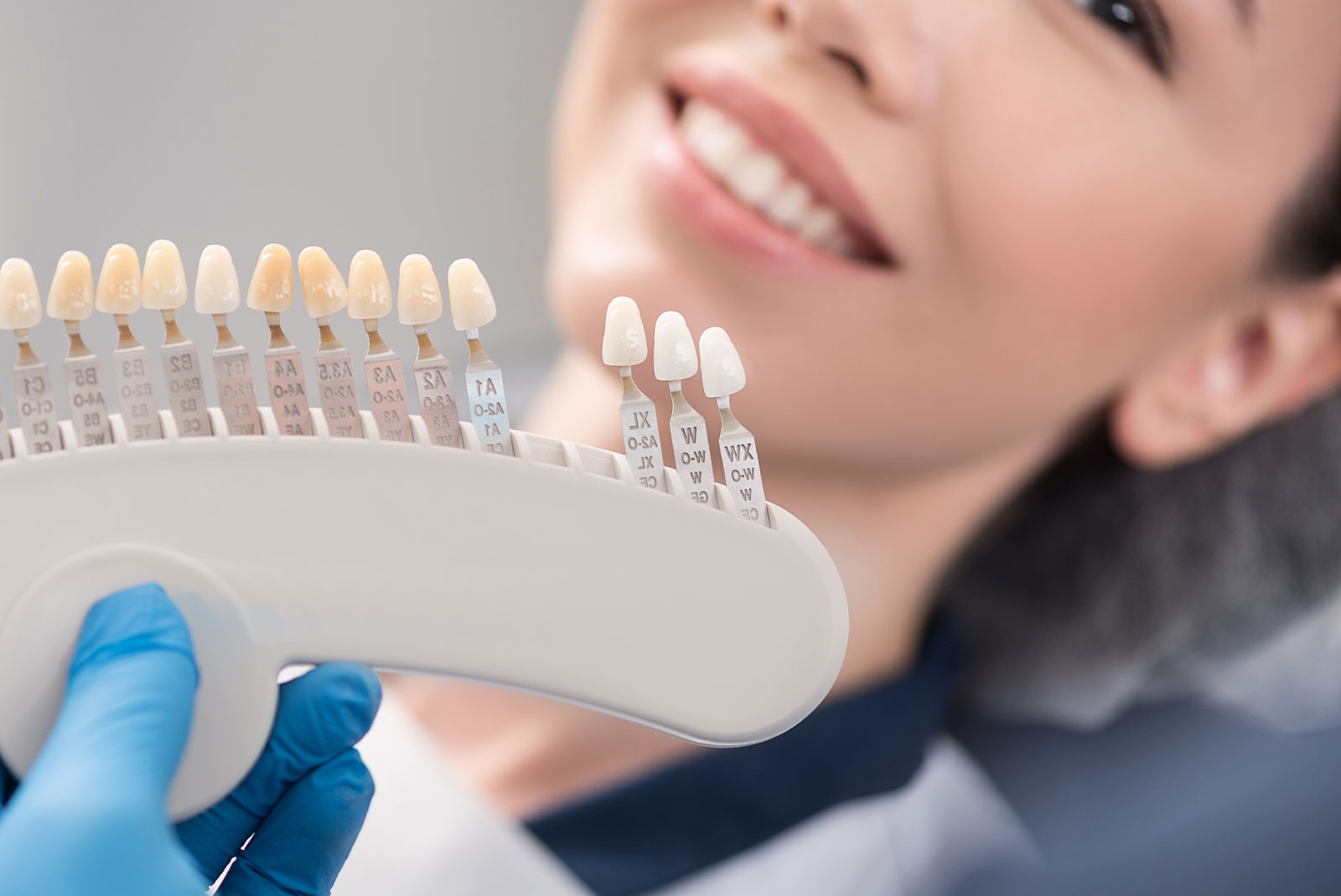 veneer choice match